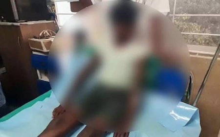 ചട്ടുകം പഴുപ്പിച്ച് 7 വയസുകാരന് പൊള്ളലേൽപ്പിച്ചു; അമ്മയെ ഇന്ന് അറസ്റ്റ് ചെയ്തേക്കും 