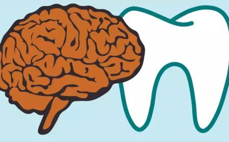 ദന്താരോഗ്യം മോശമാകുന്നത് വഴി മസ്തിഷ്‌കാഘാതത്തിനുള്ള സാധ്യത വർധിക്കുമെന്ന് പഠനം